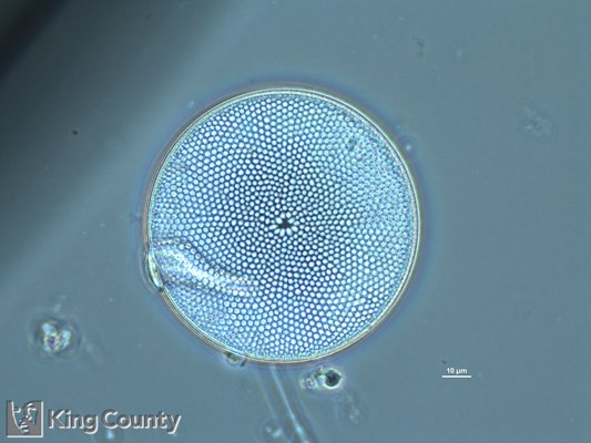 Photo of Coscinodiscus spp.